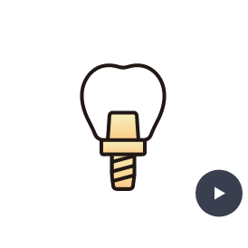 インプラント治療