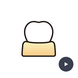 根管治療歯髄保存療法