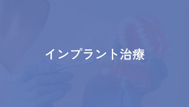 インプラント治療