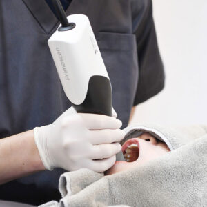 口腔内スキャナー